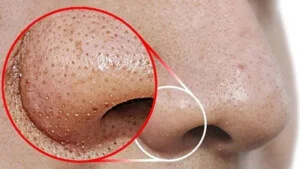 Linh Na Spa – Công Ty Cổ Phần Thuận Tài Phát