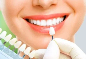 Nha Khoa Thẩm Mỹ Việt Mỹ – Công Ty TNHH MTV Nha Khoa Thẩm Mỹ Việt Mỹ