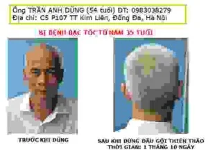 Dầu Gội Thảo Dược Thiên Thảo – Công Ty TNHH Thành Phương