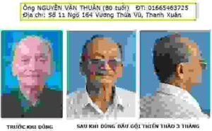 Dầu Gội Thảo Dược Thiên Thảo – Công Ty TNHH Thành Phương