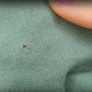 Sửa Lỗi Vải Nguyễn Thái – Công Ty Dịch Vụ Công Nghệ May Nguyễn Thái