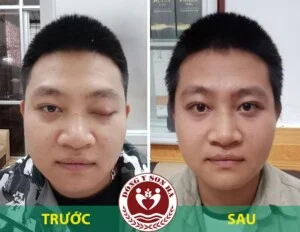 Đông Y Sơn Hà – Công Ty TNHH Đông Y Dược Sơn Hà