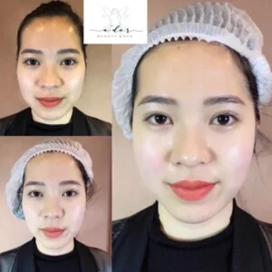 Ador Spa Đông Anh