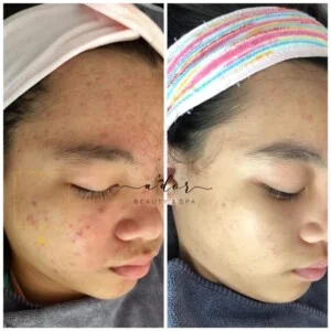 Ador Spa Đông Anh